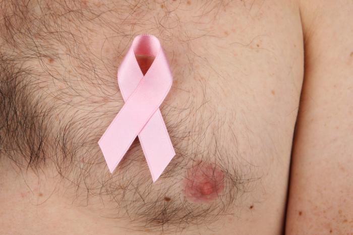 Breast Cancer in Men